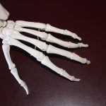 OCD Lesions & Osteochondritis